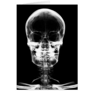 X-RAY VISION SKELETON SKULL - B&W