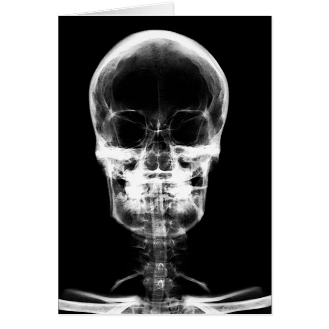 X-RAY VISION SKELETON SKULL - B&W (Front)
