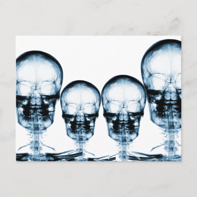 X-Ray Vision Skeleton Skull - Blue Postcard (Front)
