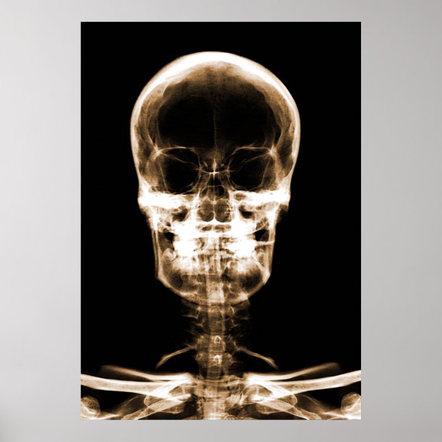 X-RAY VISION SKELETON SKULL - ORANGE POSTER (Front)