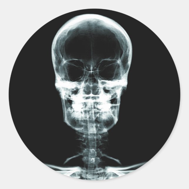 X-RAY VISION SKELETON SKULL - ORIGINAL CLASSIC ROUND STICKER (Front)