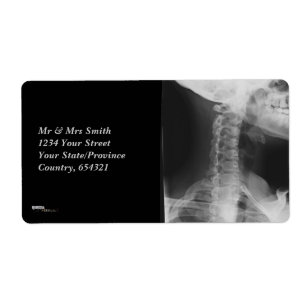 X-rayed 2