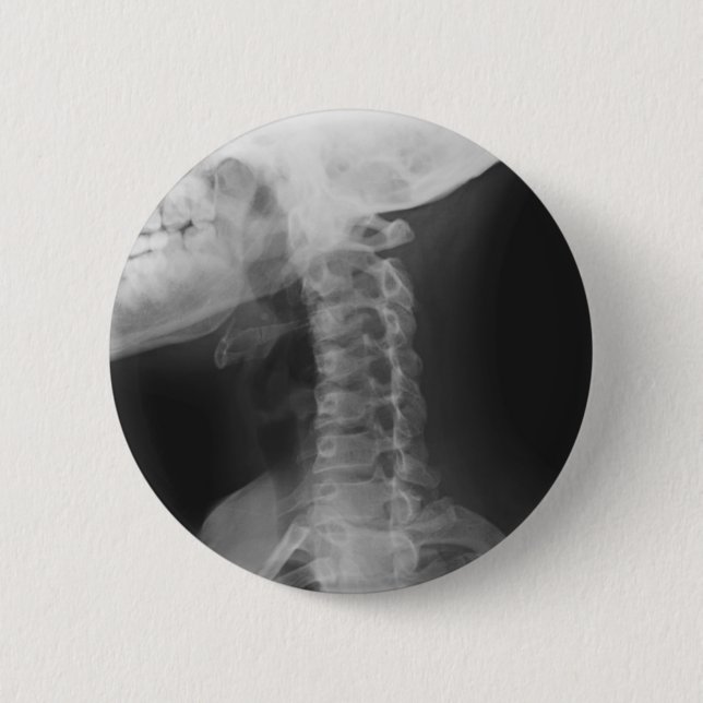 X-rayed 2 2 inch round button (Front)