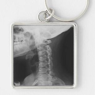 X-rayed 2 keychain