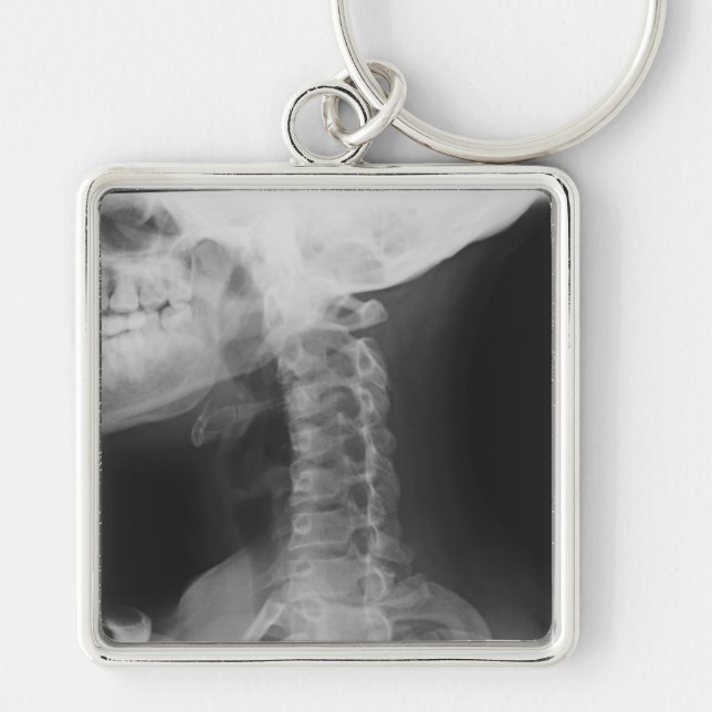 X-rayed 2 keychain (Front)