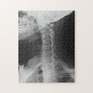 X-Rayed 2 (Original) Jigsaw Puzzle