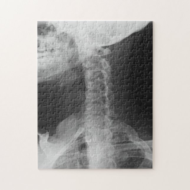 X-Rayed 2 (Original) Jigsaw Puzzle (Vertical)