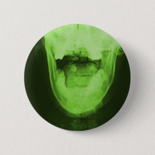 X-rayed 3 - Radioactive Green 2 Inch Round Button