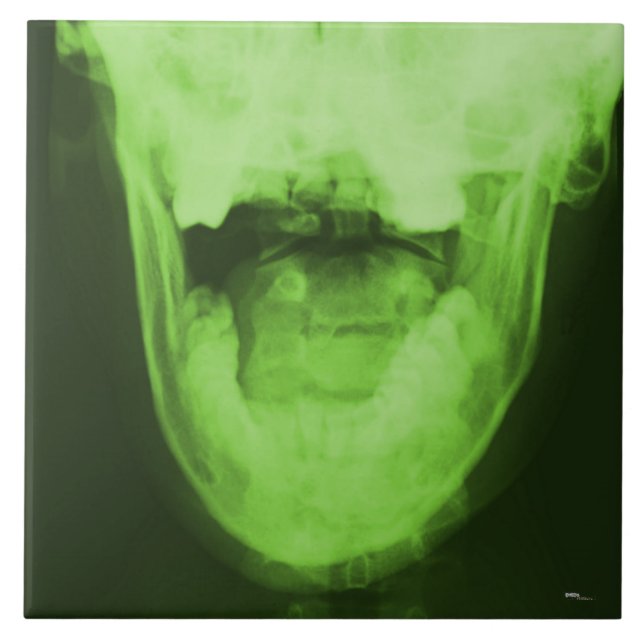X-rayed 3 - Radioactive Green Tile (Front)