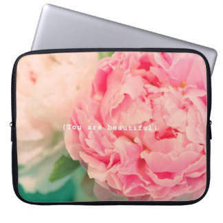 You Are Beautiful Laptop Sleeve